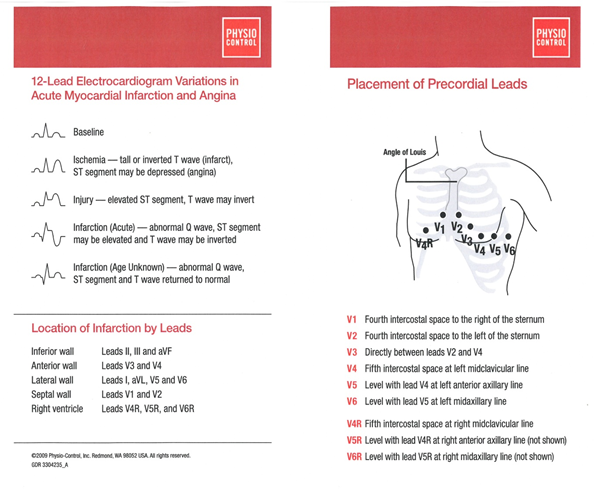 12-Lead EKG Variations in Acute Myocardial Infarction and Angina & Placement of Precordial Leads