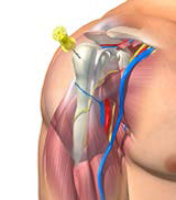 Insertion site