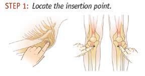 Diagram demonstrating how to locate the insertion point